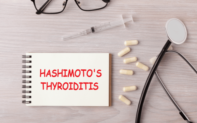 Hashimoto's Thyroiditis – Autoimmunity and Thyroid Cancer