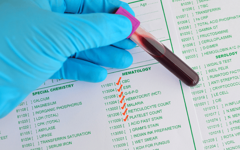 Hematological Dysfunction - A Silent Feature of MODS