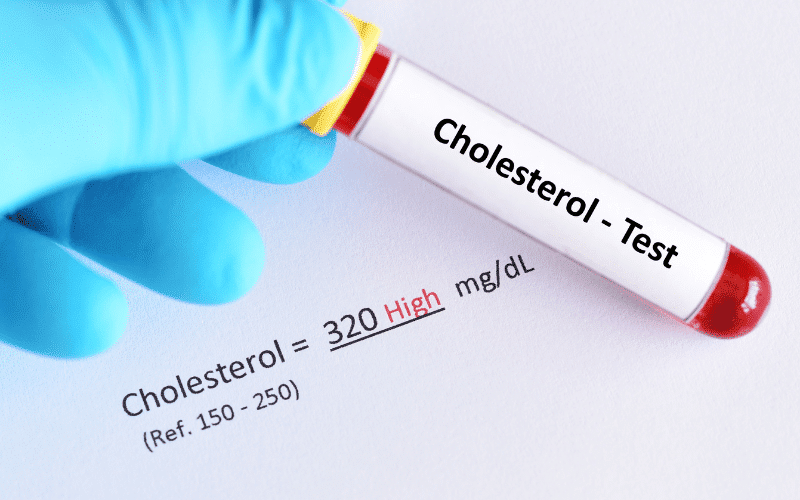 High Cholesterol - An Unseen Contributor to Vascular Dementia