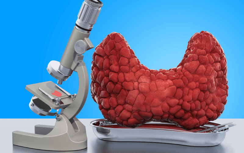 Histopathological Features PTC vs. FTC – Diving into the Microscopic World