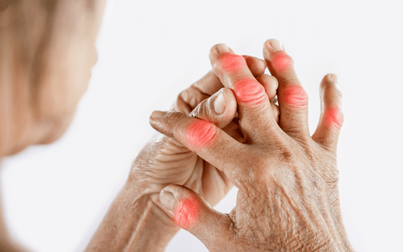 Joint Pain - The Misleading Symptom of Myopathies