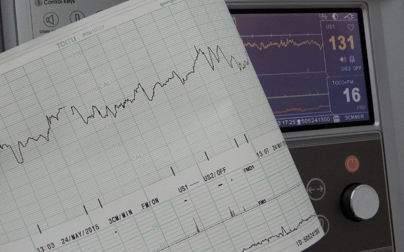 Rapid and Irregular Heartbeat