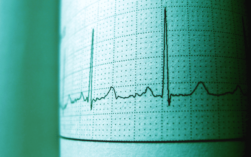 Rapid or Irregular Heartbeat