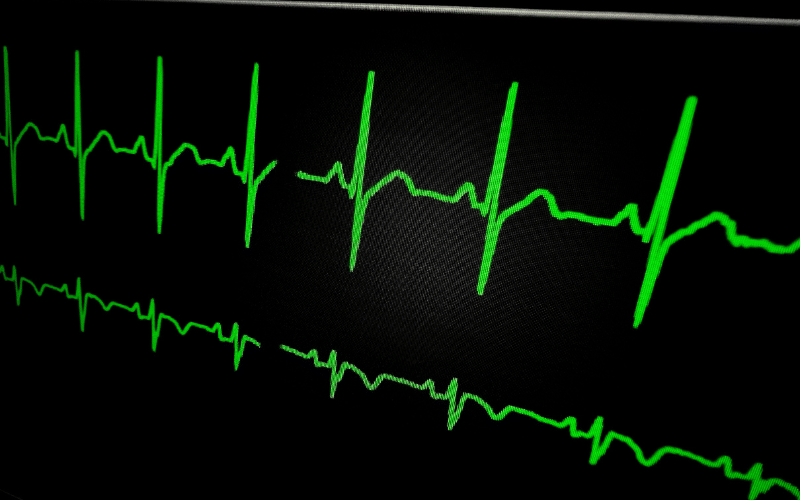 Rapid or Irregular Heartbeat When Your Heart Skips a Beat