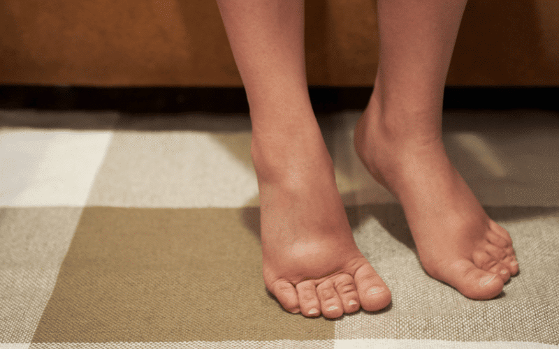 Swelling in Legs, Ankles, and Feet