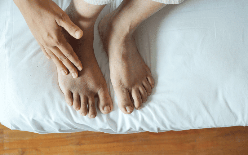 Swelling in Your Legs, Ankles and Feet