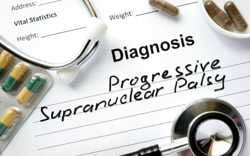 Progressive Supranuclear Palsy Decoding Its Four Integral Stages