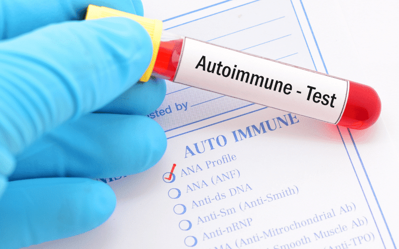 The Trojan Horse The Role of Autoimmune Reaction in HSE