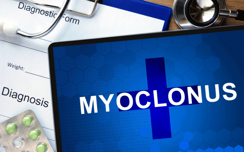 Myoclonus The Unforeseen Shudders