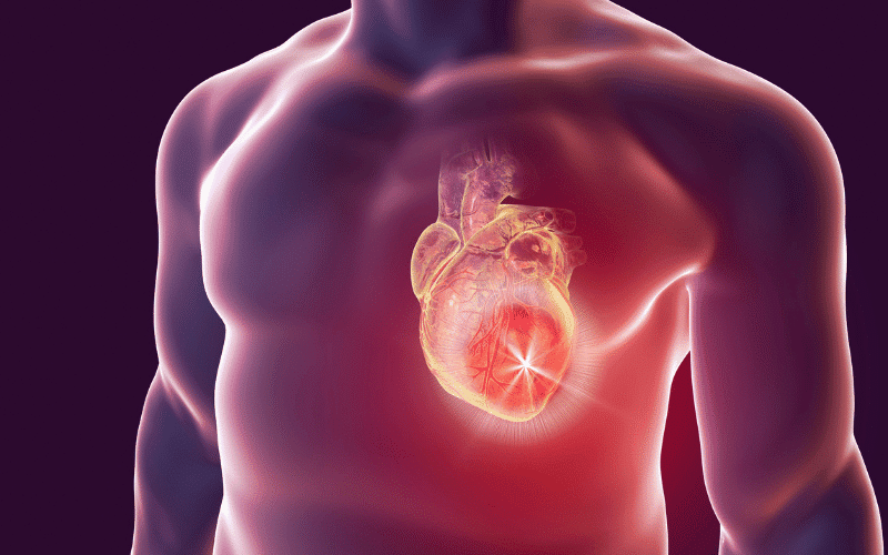 Cardiac Complications A Silent Threat