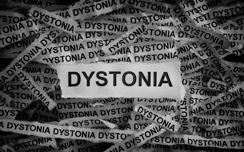 Dystonia A Battle Against Unintended Movements