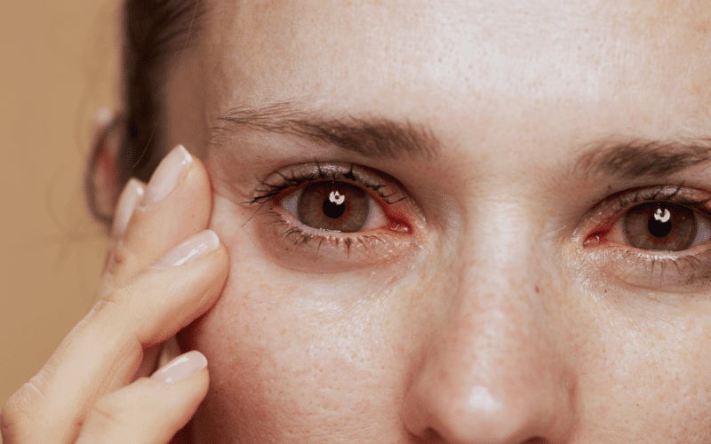 Eye Inflammation Through a Glass, Darkly