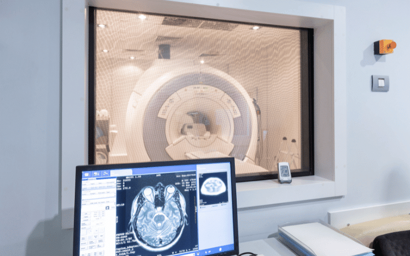 Through the Lens The Role of Brain Scans in Diagnosing Pick's Disease