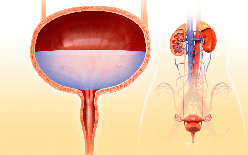 Bladder Dysfunction The Overlooked Complication of Ataxia