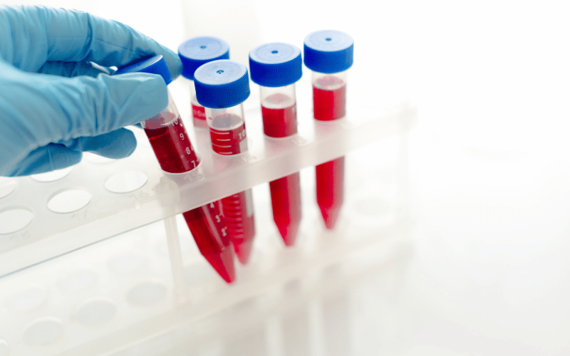 A Definitive Diagnosis - The Role of Genetic Testing