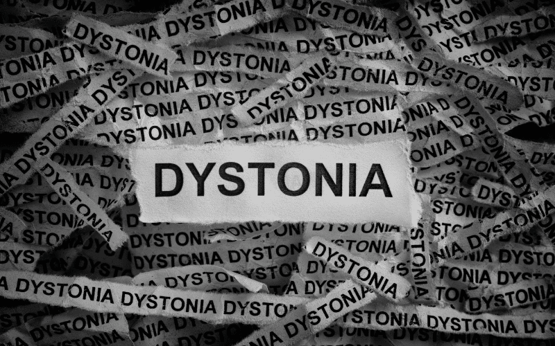 Progressive Dystonia - The Early Warning Sign