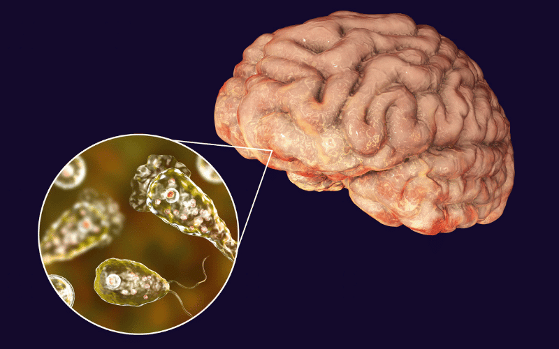 The Nature of Herpesviral Encephalitis