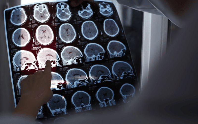 The Role of Neuroimaging