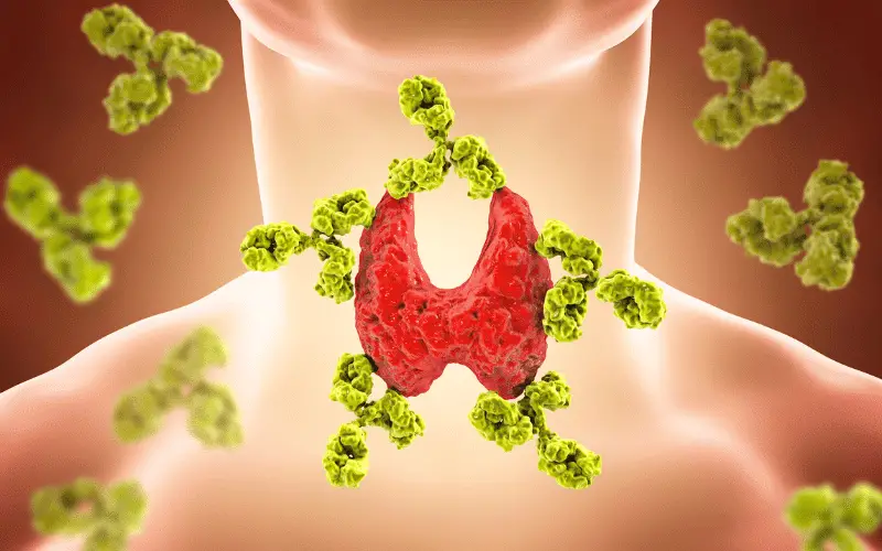 Understand Acute Infectious Thyroiditis Unveiling the Top 10 Symptoms