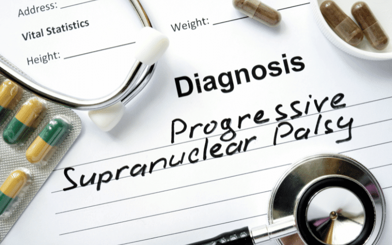 Understanding Progressive Supranuclear Palsy A Detailed Examination of Its Four Stages