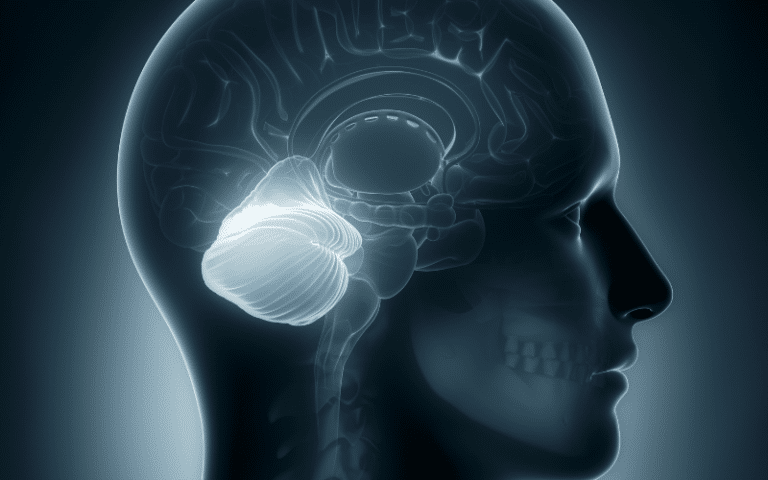 Understanding Spinocerebellar Ataxia Unveiling 15 Key Symptoms   Understanding Spinocerebellar Ataxia Unveiling 15 Key Symptoms 768x480 