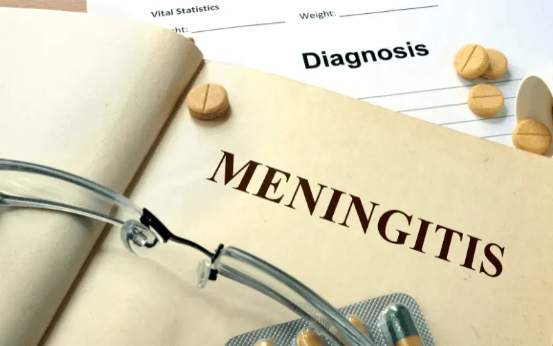 Unmasking Meningitis A Deep Dive into the Five Types