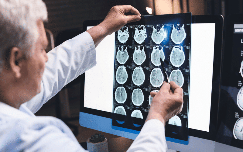 Unveiling the Layers of Concussion