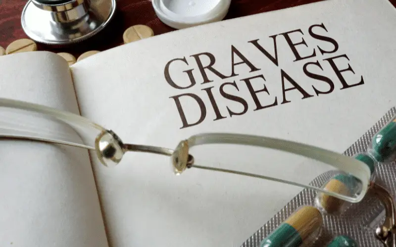 Stage 1: The Initial Stage of Graves' Disease - A Closer Look