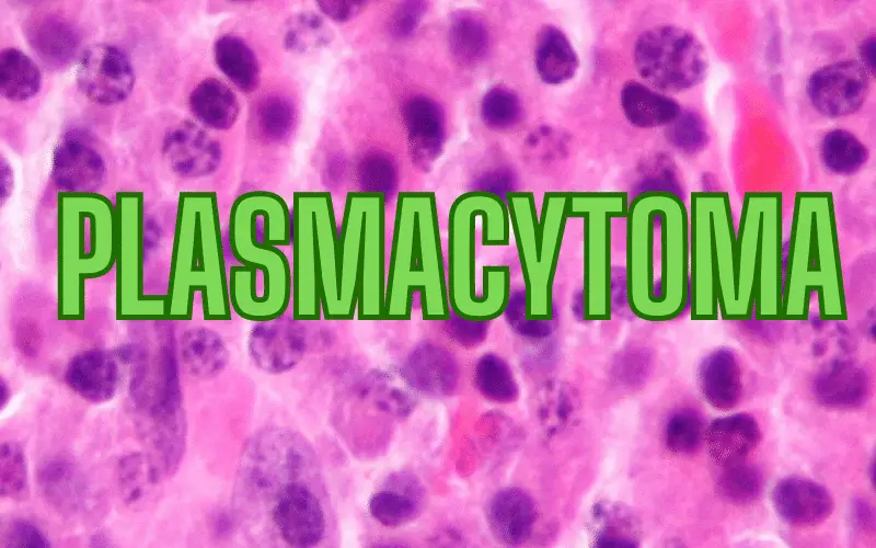 How to Spot Plasmacytoma The Top 10 Symptoms Decoded