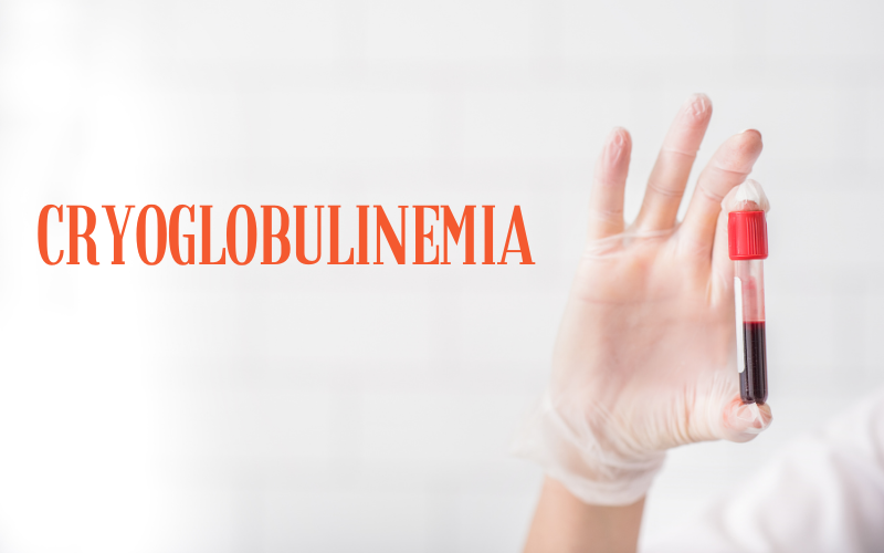 The Cryoglobulinemia Chronicle A Deep Dive into Its Three Types