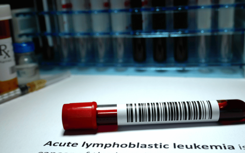 Acute Lymphoblastic Leukemia in Children Top 10 Facts for Parents