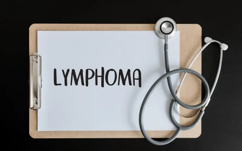 Anaplastic Large-Cell Lymphoma Top 10 Warning Signs