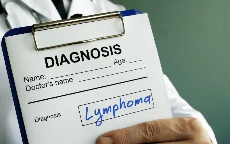 Beware And Be Aware 10 Pivotal Symptoms of Plasmablastic Lymphoma