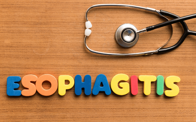 Esophagitis The 15 Facts You Need to Take Seriously