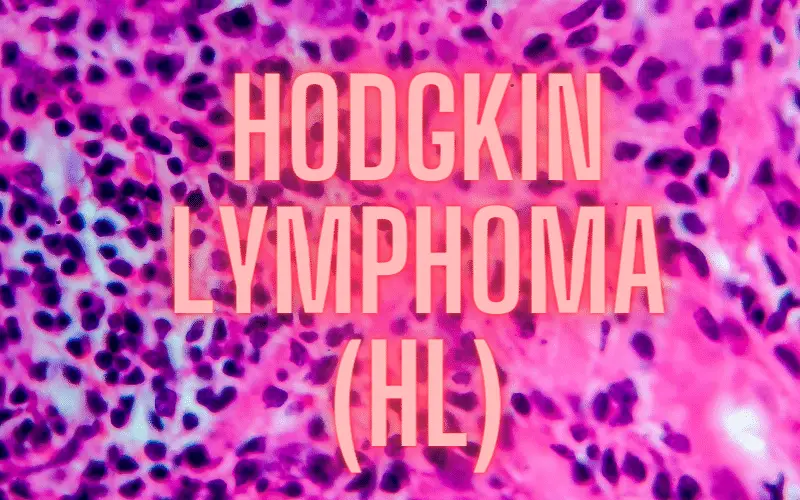 From Basics to Nuances A Tour on 15 Important Facts of Hodgkin Lymphoma