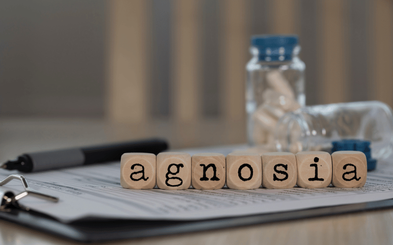 From Faces to Shapes The 10 Puzzling Symptoms of Visual Agnosia