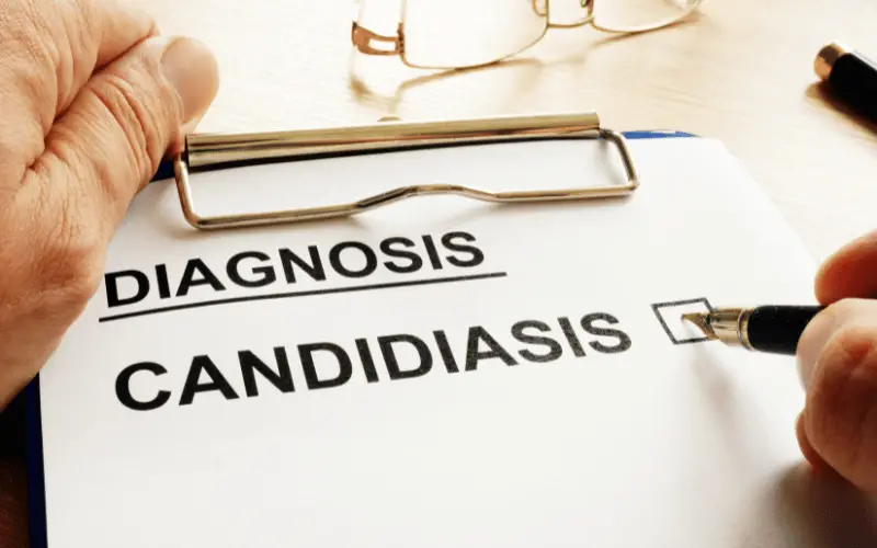 How to Recognize the Symptoms of Esophageal Candidiasis