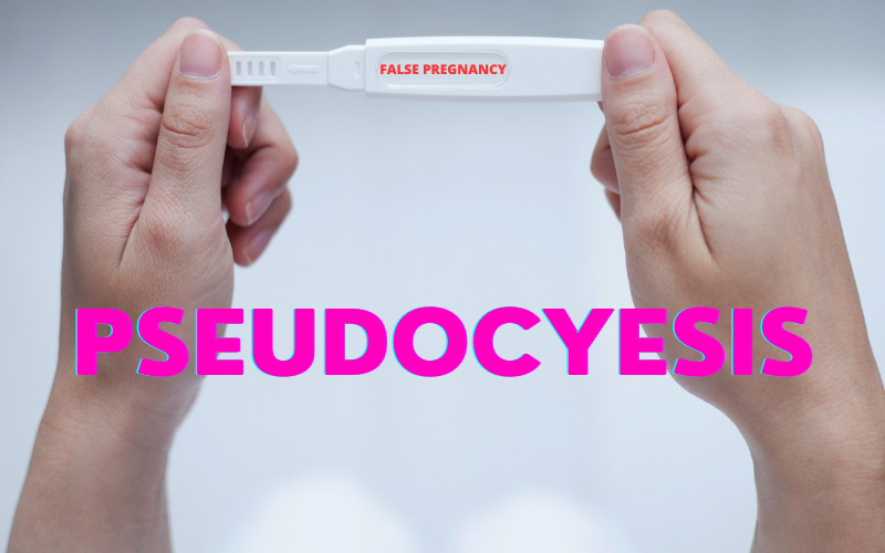 Is It Real or Pseudocyesis Distinguishing Genuine from False Pregnancy