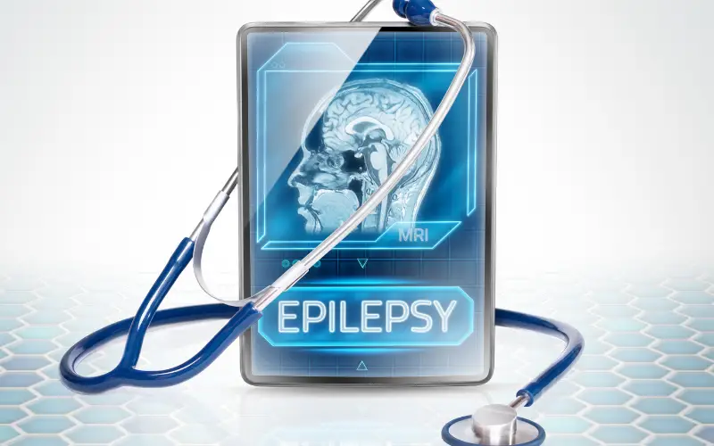 Paving the Way to Understanding Myoclonic Epilepsy 15 Important Facts