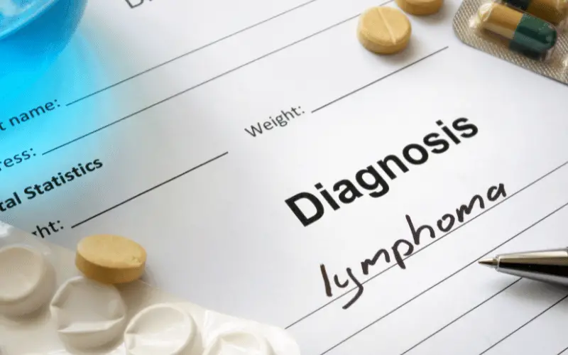 Symptoms of Burkitt Lymphoma 10 Signs That Could Save Your Life