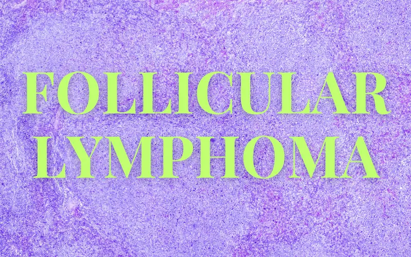 The Follicular Lymphoma Factbook 15 Essential Know-Hows