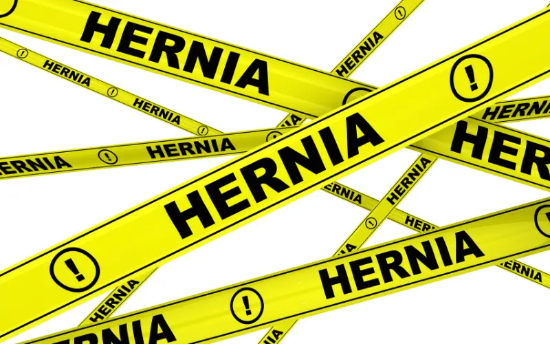 The Lowdown on Femoral Hernia and Why Women Should Care