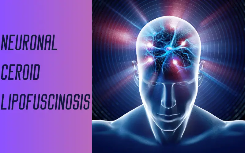 Top 10 Symptoms of Neuronal Ceroid Lipofuscinosis An Insightful Overview