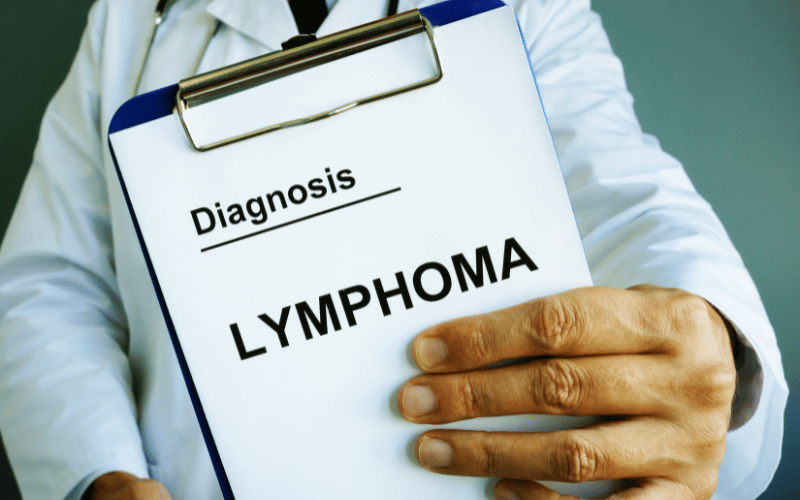Unmasking Angioimmunoblastic T-cell Lymphoma Top 10 Symptoms to Watch For