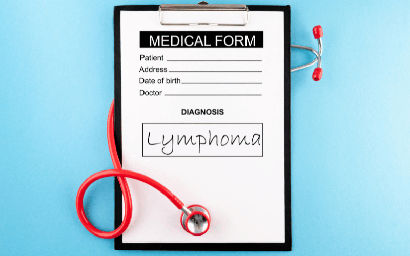 Decoding Origins The Enigmatic Story of Follicular Lymphoma