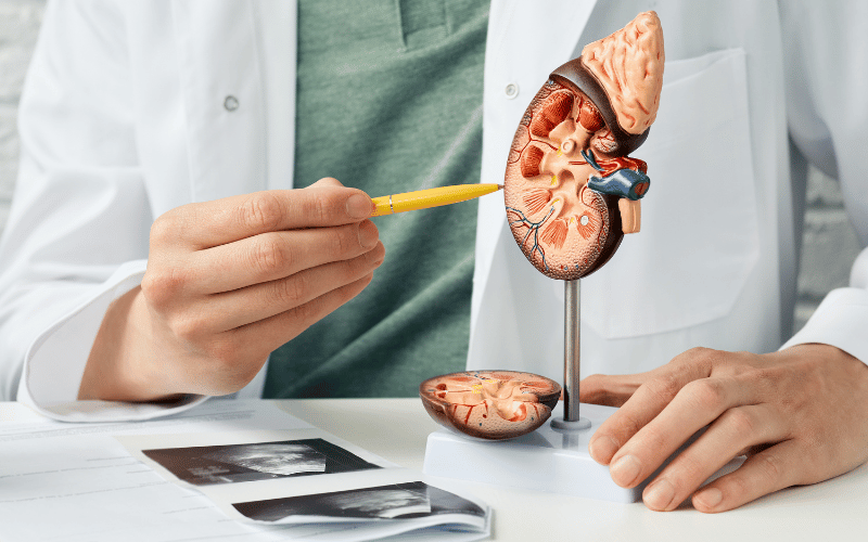Kidney Disease The Often Overlooked Cause of Proteinuria