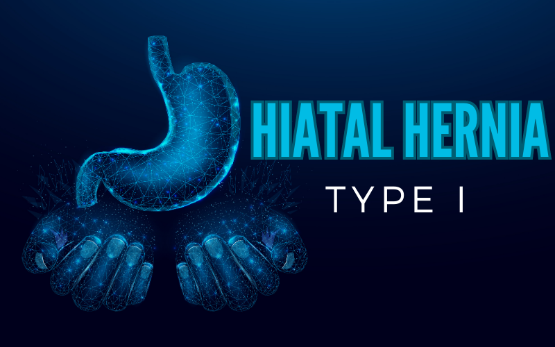 Sliding Hiatal Hernia The Most Common Culprit