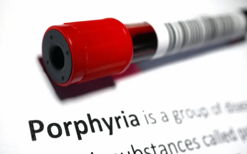 10 Major Symptoms of Porphyria Cutanea Tarda (PCT) Every Patient Should Be Aware Of