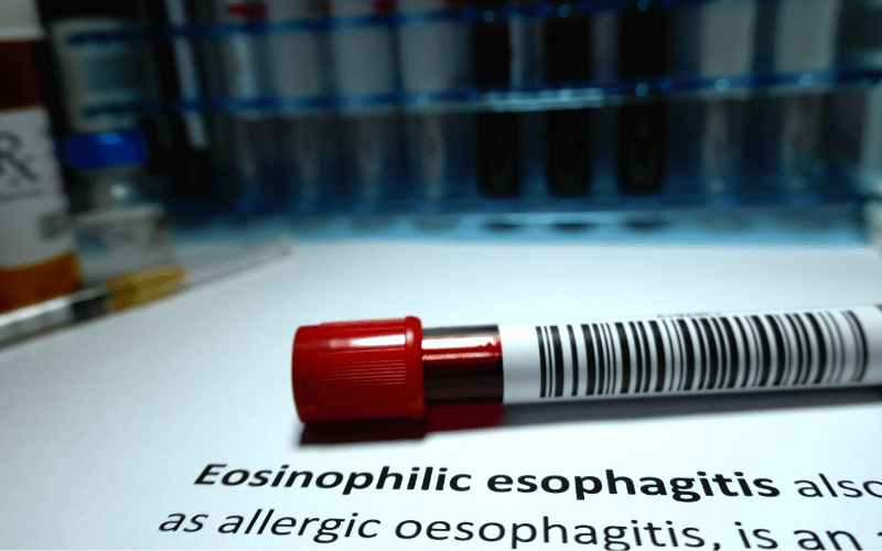 10 Telltale Symptoms of Eosinophilic Esophagitis (EoE) in Children