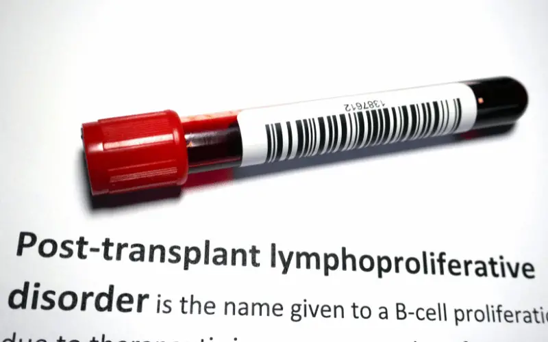 10 Telltale Symptoms of Post-Transplant Lymphoproliferative Disorder (PTLD)